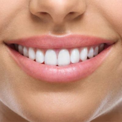 Tratamientos - Estética Dental Bogotá